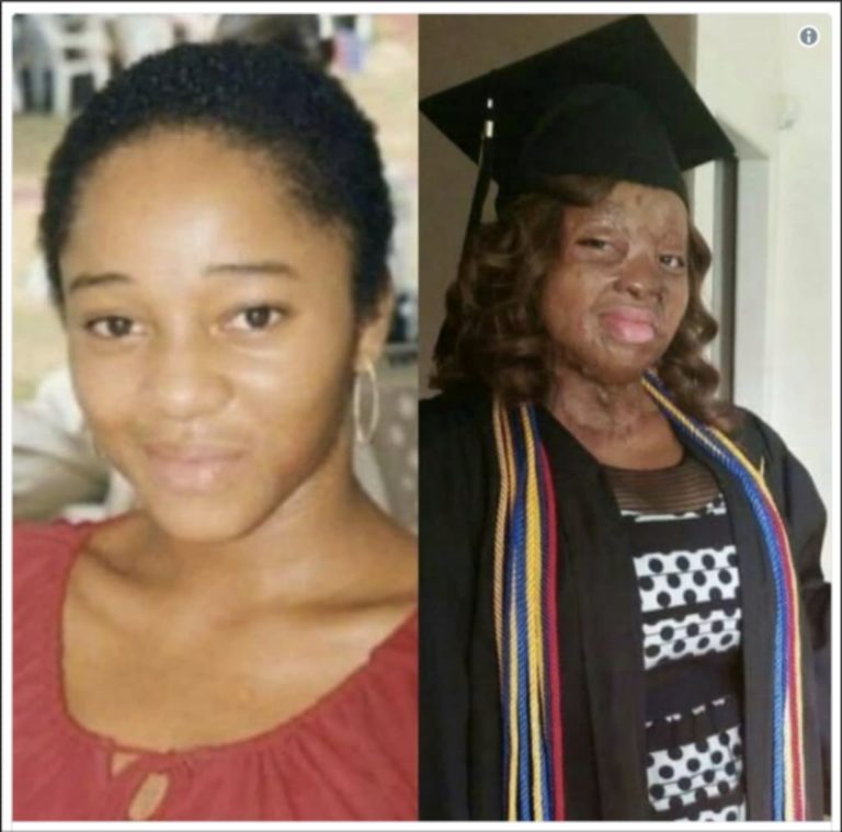 Plane Crash Survivor Kechi Okwuchi Sings 'Have a Little Faith in Me'