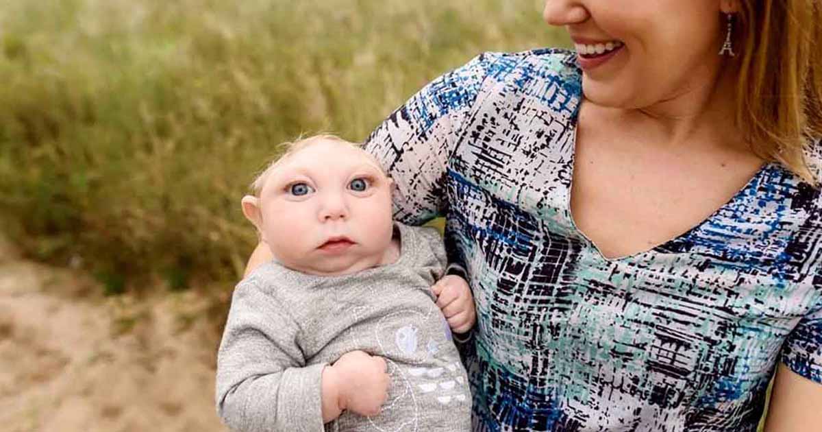 Miracle Baby Born With Missing Skull Defies Doctors' Predictions | FaithPot