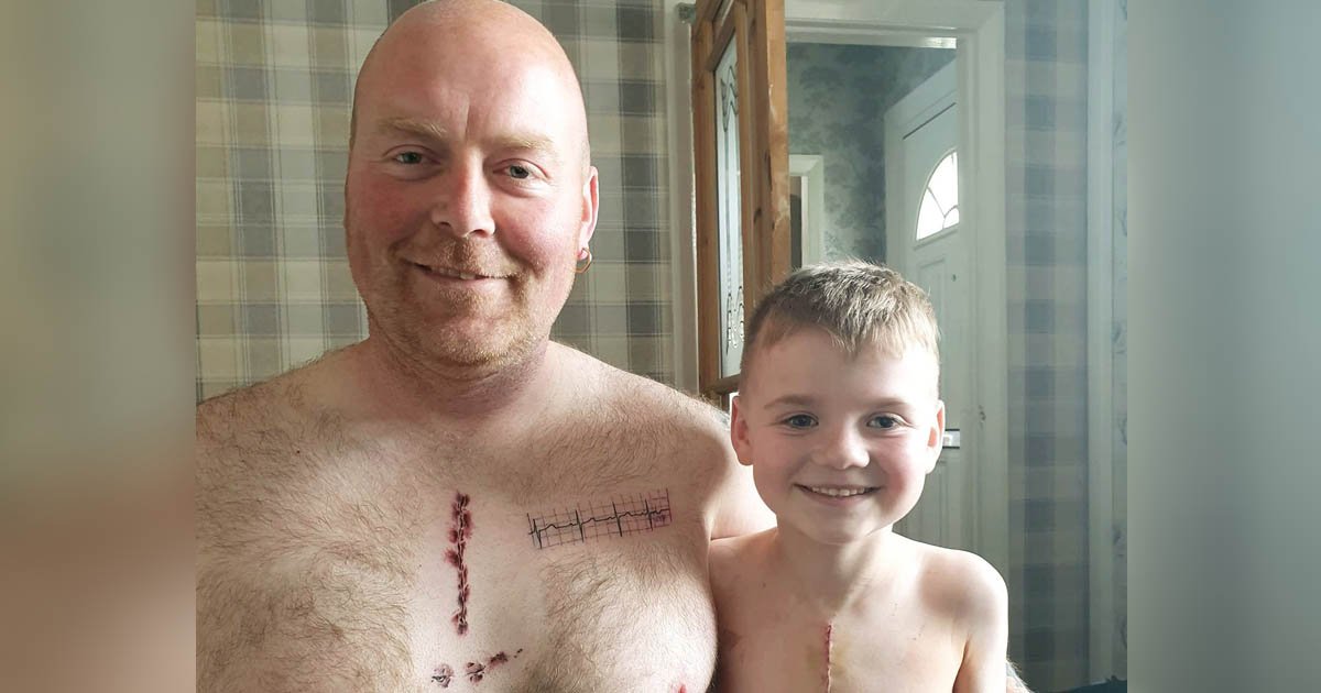 Dad gets tattoo to match daughter's scar from open-heart surgeries - Good  Morning America