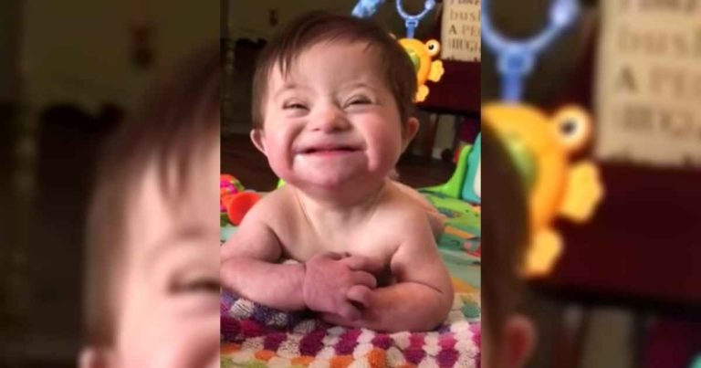adopted-child-with-down-syndrome