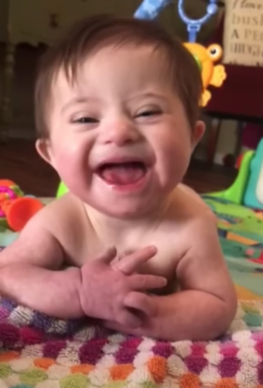 Adopted Baby With Down Syndrome Melts Hearts Everywhere FaithPot
