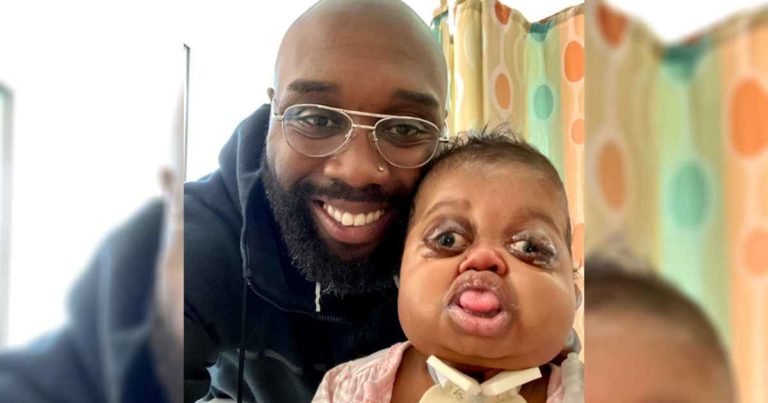 dad-writes-letters-to-baby-with-pfeiffer-syndrome