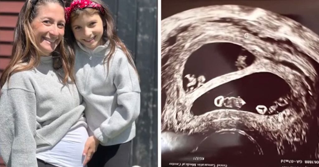 Mom Who Lost 4 Babies Is Now Pregnant With 2 Sets of Identical Twins(01)