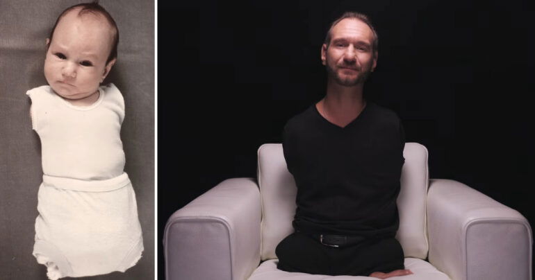 life without limbs Nick Vujicic i am second